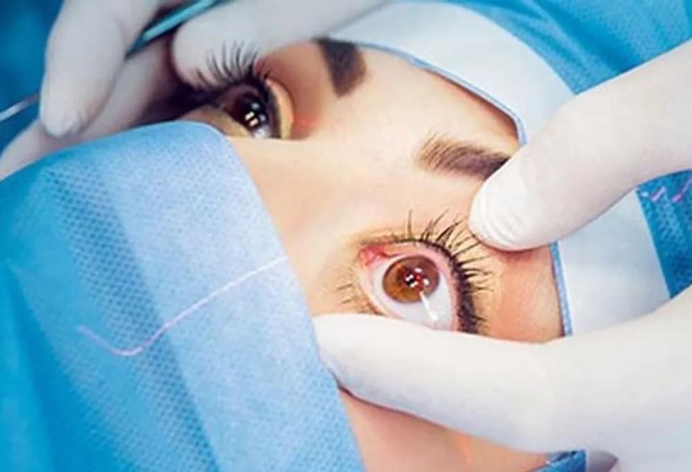 जुम्लामा एक सय बाइस जनाको मोतिविन्दुको निःशुल्क शल्यक्रिया